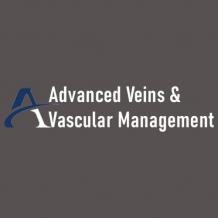 Varicose Vein management Michigan