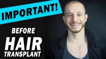 5 things to think about before getting a hair t... - Hair Transplant Dubai Clinic - Quora