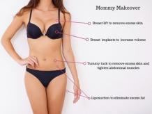  Mommy Makeover Surgery in India - Healing Touristry