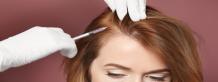 Why mesotherapy is best option for hair fall? | Hair Transplant Dubai