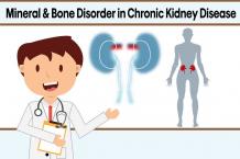 Mineral And Bone Disorder In Chronic Kidney Disease