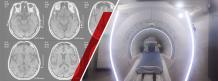 MRI Scan in Kandivali | MRI Scan Near Me | MRI Scan