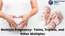  Multiple Pregnancy: Twins, Triplets, and Other Multiples