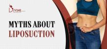 9 Myths About Liposuction