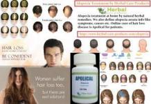 10 Natural Treatments for Alopecia Areata - Herbal Care Products