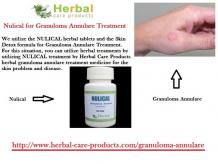 10 Natural Remedies for Granuloma Annulare - Herbal Care Products