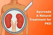 Ayurveda- A Natural Treatment for Polycystic Kidney Disease