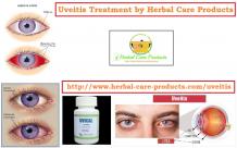 10 Natural Remedies for Uveitis - Herbal Care Products