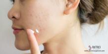 Need Prescription Acne Relief? Buy Differin Cream for Acne Treatment.