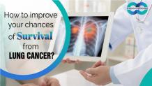 How to improve your chances of survival from lung cancer