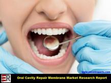 Global Oral Cavity Repair Membrane Market Expected to Deliver Dynamic Progression until 2024