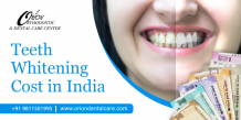 Dental Clinic In Greater Kailash 1 - Orion Dental Care    