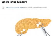 Pancreatic Cancer - Where is the Tumour | Cytecare Hospital  