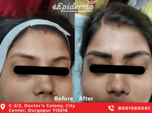 #1 Best Permanent Eyebrow Makeup in Durgapur