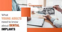 What Young Adults Need To Know About Dental Implants