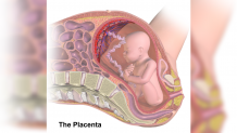 Fundal Posterior Placenta: What is It During Pregnancy; Is it Good or Bad? &ndash; PregaJunction