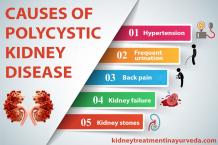 Polycystic Kidney Disease Treatment In Ayurveda