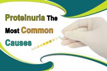  Proteinuria - The Most Common Causes