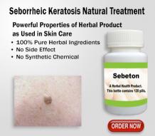 Effective Natural Remedies for Seborrheic Keratosis