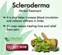 Natural Remedies for Scleroderma to Treat Painful Joints