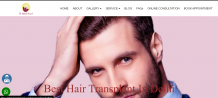 Best Hair Transplant in Delhi 