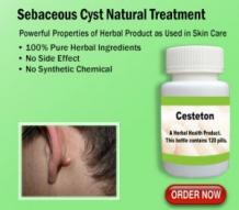 Natural Remedies for Sebaceous Cyst to Prevent This Disease