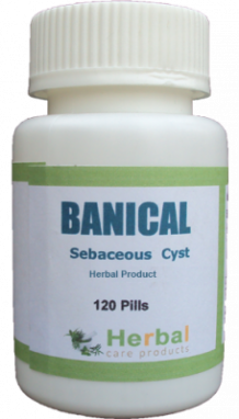 Sebaceous Cyst : Symptoms, Causes and Natural Treatment - Herbal Care Products