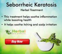 Herbal Care Products: Natural Home Remedies for Seborrheic Keratosis Everything You Need to Know