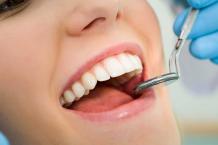 Prefabricated Dental Post &amp; Core | Uptown Dentist Houston | Urbn Dental