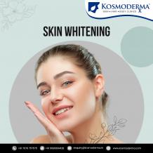 Laser Skin Whitening & Skin Lightening Treatment In Bangalore at Kosmoderma