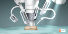 Robotic Surgery Treatment in India: Unraveling the Future of Medicine