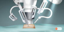 Robotic Surgery Treatment Cost in India