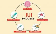 iui treatment cost