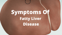 Symptoms Of Fatty Liver Disease