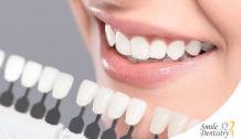 Teeth Whitening Calgary SE – Top-notch Dental Care for a Great Smile &#8211; smile32dentistry