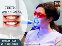 Professional Teeth Whitening 