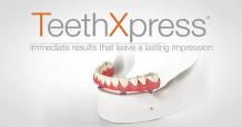 TeethXpress Implants The Woodlands