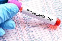 Thyroid Profile Test 