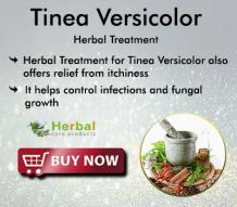 Herbal Care Products | Natural Herbal Remedies Information : Natural Remedies for Tinea Versicolor Get Rid of Fungal Infection