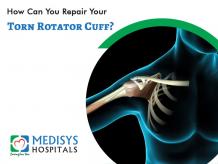 Shoulder Replacement | Rotator Cuff Surgery | Medisys Hospitals