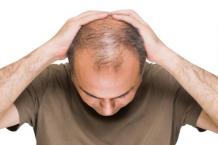 Is Hair Transplant Painful Procedure? | Hair Transplant Dubai