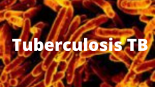 Tuberculosis TB Meaning, Symptoms, Causes, Test And Vaccine