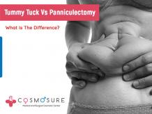 Tummy Tuck Vs Panniculectomy : Which is Best | Cosmosure Clinic