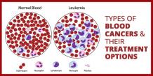 Types of Blood Cancers and their Treatment Options - Onco-Life Cancer Centre