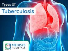 Types Of Tuberculosis (TB) | Medisys Hospitals