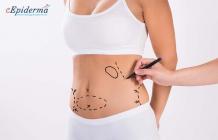 #No1 Ultrasonic Liposuction in Durgapur