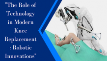 Innovations In Modern Robotic Knee Replacement Surgery