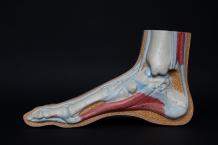 Achilles Tendon Doctor - Achilles Tendonitis Podiatrist