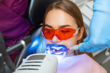 Professional Teeth Whitening at KAA Dentals for bright smile