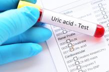 Uric Acid Test in Mumbai